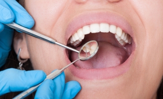 4 dấu hiệu ở miệng cảnh báo bệnh nguy hiểm