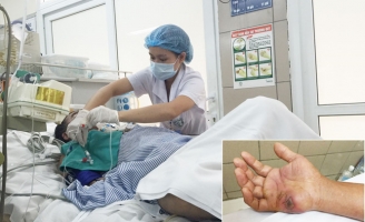 Phòng rắn cắn mùa du lịch